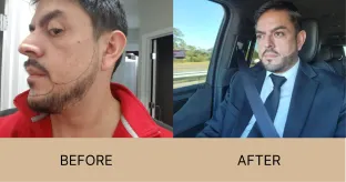 Before / after
